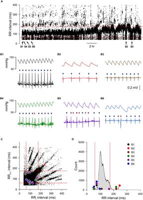 The Use of Percent Change in RR Interval for Data Exclusion in Analyzing 24-h Time Domain Heart Rate Variability in Rodents